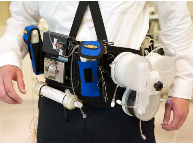 Автор: Аліна Мірошникова, редактор перші переносні штучні нирки довели свою зручність і ефективність